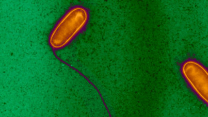 Savoie : le seuil de légionelles dépassé chez Framatome à Ugine